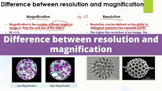 Calculating Magnification IB Biology [upl. by Enomis528]