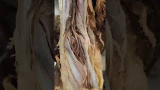 Dissection of Popliteal Fossa  Boundaries amp Contents [upl. by Rimas775]