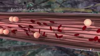 Acute Inflammation Educational 3D Animation [upl. by Mccready888]