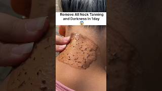 How To Remove Neck Darkness amp Tanning In 1dayNeck Cleaning Tips beautytips ytshorts viral neck [upl. by Asilehs35]