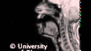 MRI voiced labiodental fricative [upl. by Tolkan]