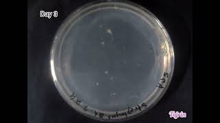 Growth of Streptomyces bacteria on Starch Casein Agar media From day 17 [upl. by Kelda]