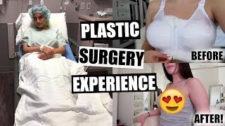 MY PLASTIC SURGERY EXPERIENCE AT 19 was it worth it [upl. by Eelytsirk]