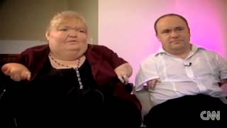 CNN Love Story Thalidomide victims find love [upl. by Hoye201]