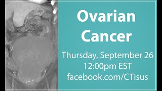 FacebookLive Ovarian Cancer [upl. by Saylor]