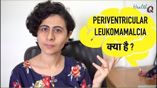 PERIVENTRICULAR LEUKOMALACIA KYA HAI [upl. by Polinski129]