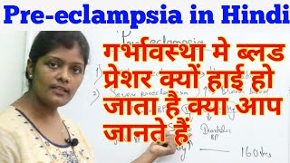 Preeclampsia lecture in hindi  प्रीएक्लेम्पसिया  Types amp causes  Hypertensionprotienureaoedema [upl. by Lombard]