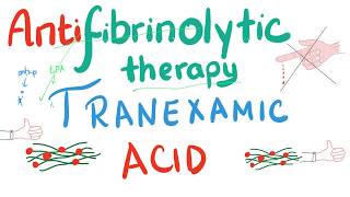 Antifibrinolytics Part 1 [upl. by Ardnasal]