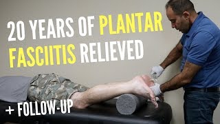 20 Years of Plantar Fasciitis RELIEVED With ASTR FOLLOWUP [upl. by Etnuahc]