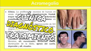 ⚕️🩺 Acromegalia y Gigantismo HIPERSECRECIÓN DE HORMONA DEL CRECIMIENTO Síntomas y Tratamiento [upl. by Anauqahc955]