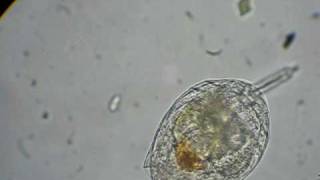 rotifer feeding on algae [upl. by Elfrida]