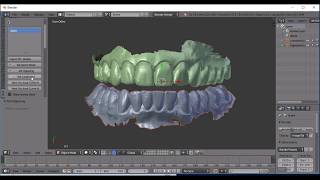 Flat Plane Occlusal Splint Workflow [upl. by Nosa]