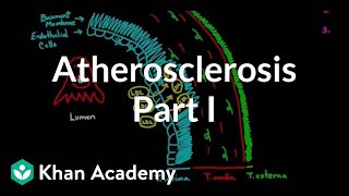 Atherosclerosis  part 1  Circulatory system diseases  Health amp Medicine  Khan Academy [upl. by Gresham]