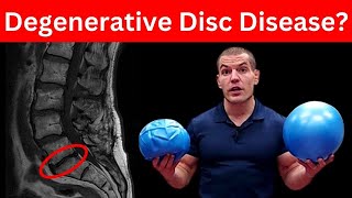 4 MustDo Exercises For Degenerative Discs In Lower Back Dont Skip These [upl. by Redliw44]