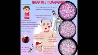 Skin hemangiomas in children Why do they occur What dangers do skin hemangiomas pose to children [upl. by Leruj]