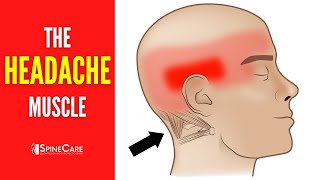 The Headache Muscle How to Release It for INSTANT RELIEF [upl. by Deeyn]