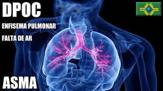 DPOC  Doença Pulmonar Obstrutiva Crônica  ASMA  FALTA DE AR  Enfisema Pulmonar [upl. by Ahsinnek668]