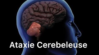 🔻 Comprendre LAtaxie cerebeleuse en 20 min seulement   Neurologie  4ème année medecine [upl. by Egdamlat244]