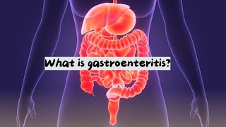 What is gastroenteritis  About gastroenteritis  gastroenteritis  gastroenteritis problem [upl. by Annayak]