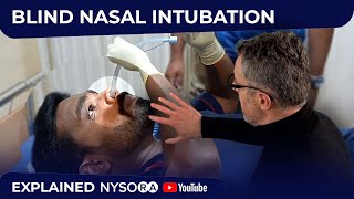 Blind Nasal SelfIntubation  Crash course with Dr Hadzic [upl. by Slaohcin]