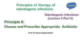 Principles of therapy of Odontogenic Infections Part 5  Choose amp Prescribe Appropriate Antibiotic [upl. by Tnecnev958]