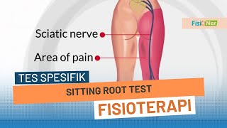 Sitting Root Test  Mengetahui adanya penjepitan saraf [upl. by Attey77]