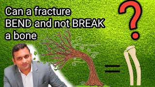 Can a fracture BEND and not BREAK a bone   Greenstick fracture  Tamil  தமிழ் [upl. by Adnof]