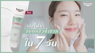 ใหม่ เจลโฟมจบทุกสิวซ้ำซากใน 7 วัน EUCERIN 3X TREATMENT GEL TO FOAM CLEANSER [upl. by Adnowat]