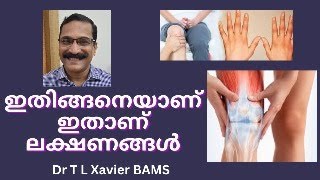 Dr T L Xaviers Shocking Rheumatic Fever Relief Discovery [upl. by Jung]