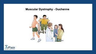 Muscular Dystrophy  Duchenne [upl. by Stew]