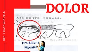 🥵Muelas del juicio cuánto dura el dolor pericoronaritis😲 [upl. by Torry344]