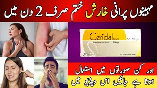 Ceridal 10mg tablet uses in urdu  Cetrizine tablet  Anti allergic tablet  How to use [upl. by Nnoj424]