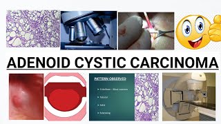 ADENOID CYSTIC CARCINOMA  COMPLETE DISCUSSION  IMAGES [upl. by Barta]