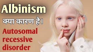 Albinism in hindi  what is albinism  biochemistry  causes diagnosis treatment [upl. by Menken]