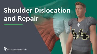 Shoulder Dislocation and Repair [upl. by Ahsead26]