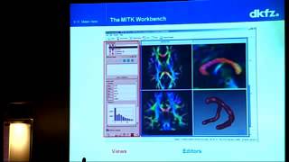 16  K MaierHein  MITK  Medical Imaging Toolkit software for DTI processing [upl. by Yehudit]