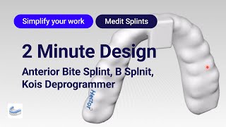 2 Minute Design  Anterior Bite Splint B Splint Kois Deprogrammer [upl. by Rinna]