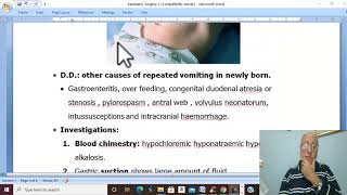 Paediatric Surgery in Arabic 4 Congenital Hypertrophic Pyloric Stenosis   by Dr Wahdan [upl. by Arikihs892]