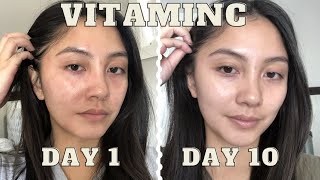 adding VITAMIN C serum to my skincare routine for 10 days  Vichy LiftActiv before amp after [upl. by Anida200]