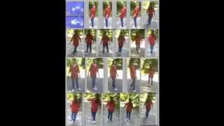 Video 9  Ataxia  Freeze frames  Ataxie  Arrêts sur images [upl. by Weld]