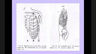 Precordium Palpation Percussion [upl. by Assehc140]