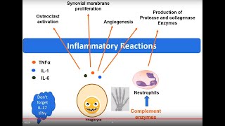 Rheumatoid Arthritis pathology in 5 minutes [upl. by Reeta334]