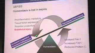 Shock Organ Failure and MOF [upl. by Llerraf]