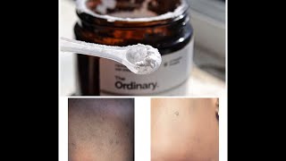 How to use the Ordinary LAscorbic Acid Powder For Bright Glowing Skin 2019 [upl. by Mcnalley]