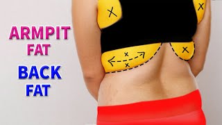 5 Simple Exercise to burn Back amp Armpit Fat [upl. by Erbma]