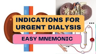 Indications For Urgent Dialysis  Easy Mnemonic [upl. by Banks84]