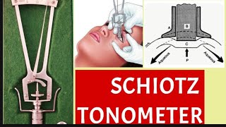 Schiotz Tonometry parts principle procedure and disadvantages [upl. by Colwin]