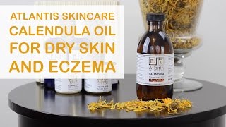 Calendula Oil for Dry Skin and Eczema [upl. by Claudelle]