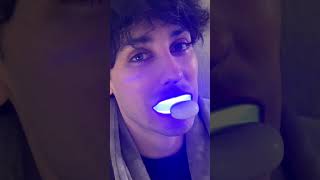 Auraglow is the BEST way to whiten your teeth this summer [upl. by Rego47]