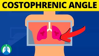 Costophrenic Angle Medical Definition  Quick Explainer Video [upl. by Oiramrej849]